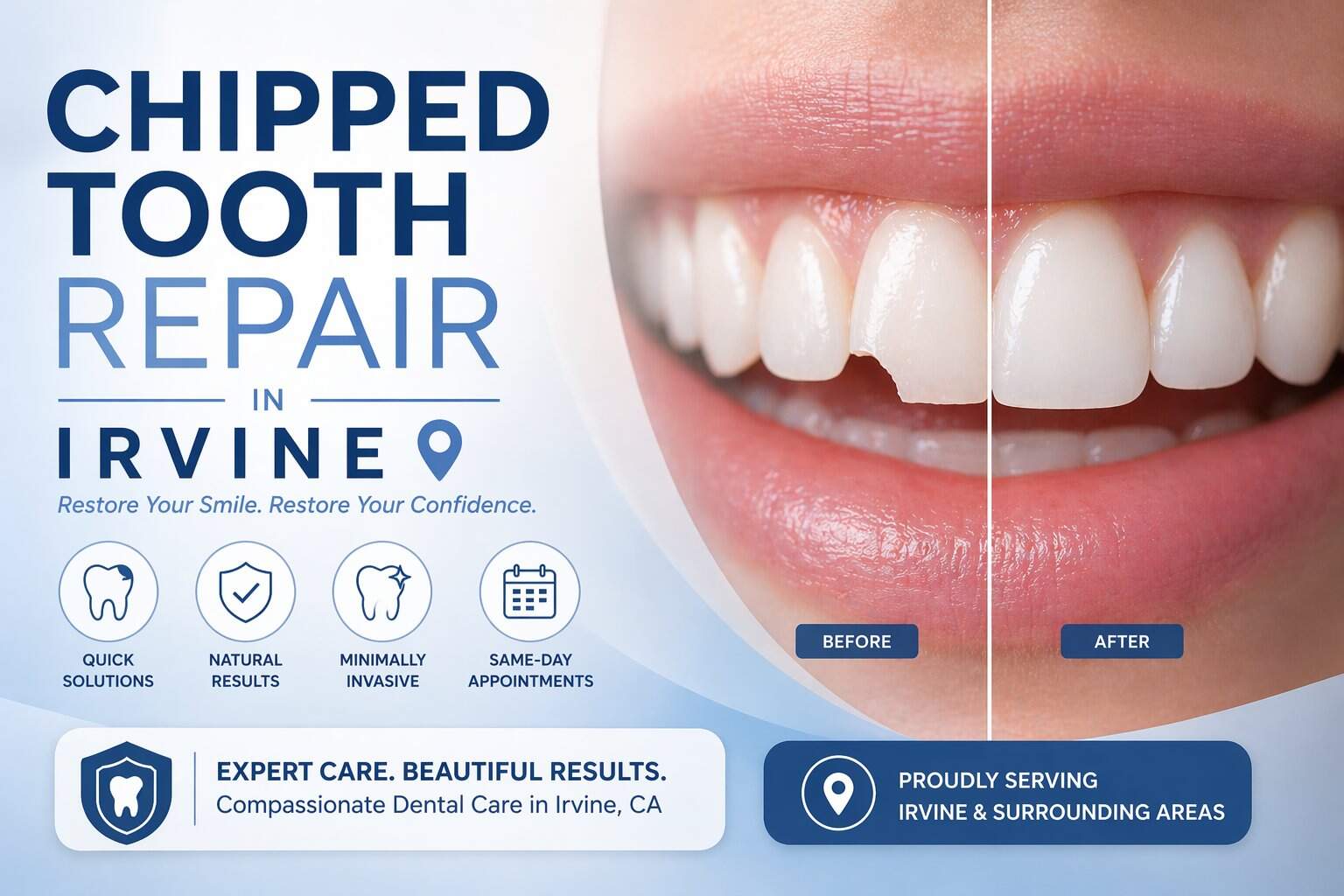 chipped tooth repair irvine
