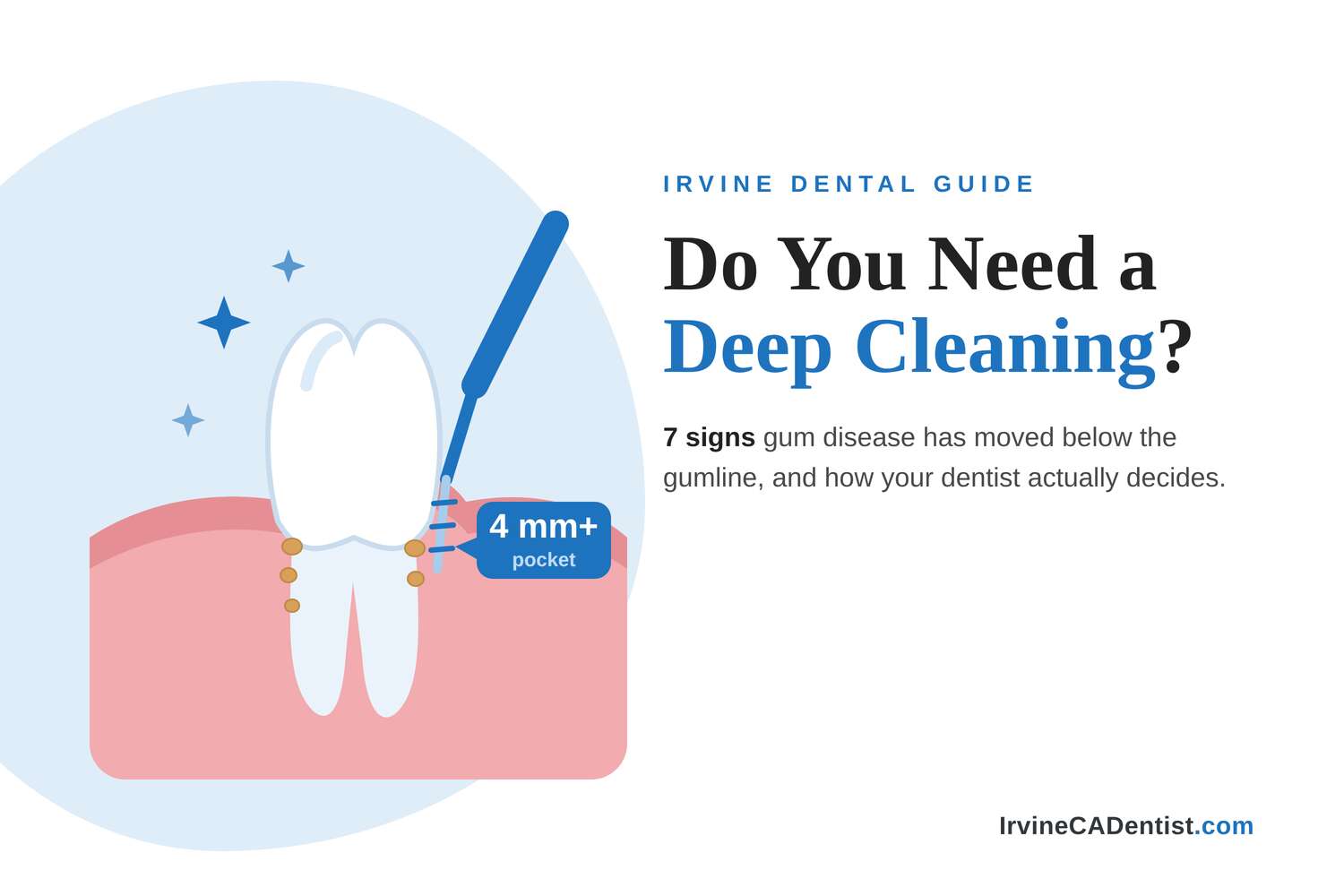 signs you need deep cleaning irvine ca