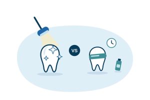 dentist vs at home diy teeth whitening